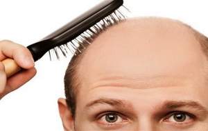 درمان ریزش مو با یک گیاه دارویی