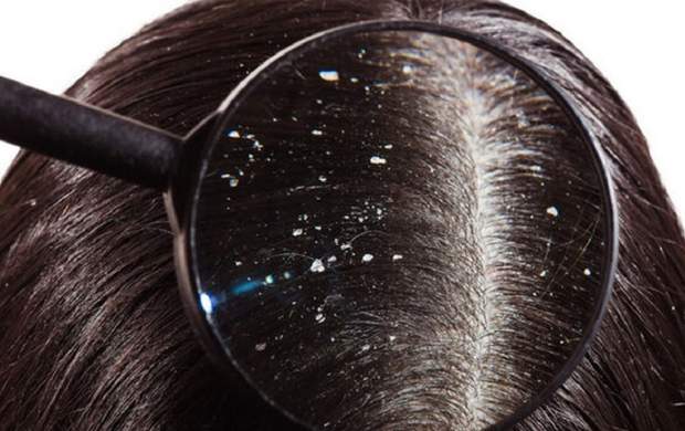 ۱۰ اشتباه رایجی که به موی شما آسیب می‌رساند