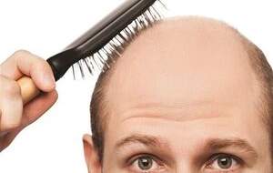 آیا ریزش مو از عوارض کرونا است؟