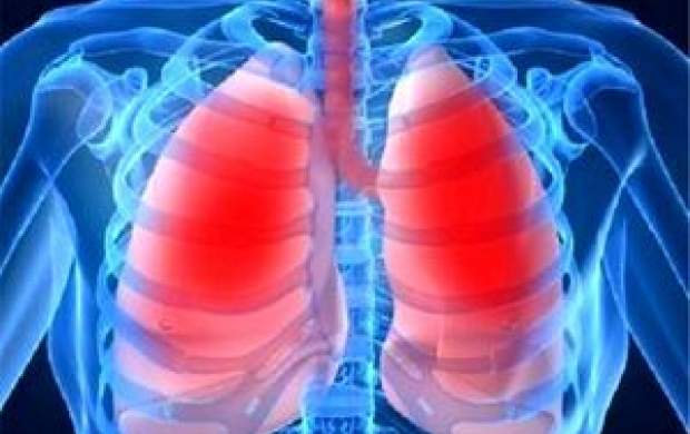 عوامل موثر در ایجاد سرطان ریه چیست؟