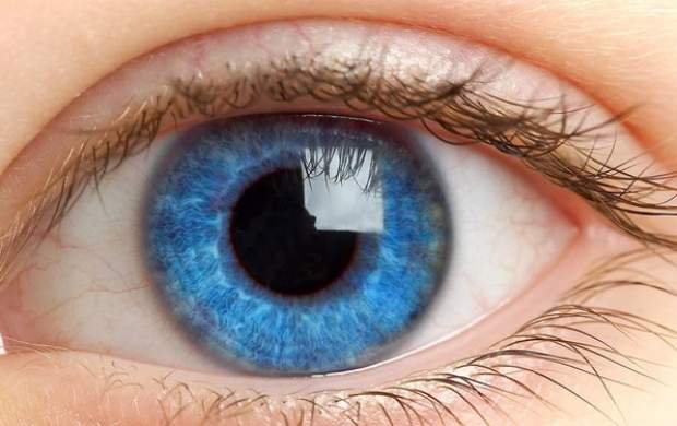 استفاده از «لنز زیبایی» در چشم چه خطری دارد؟