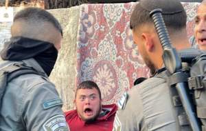 حمله به جوان مبتلا به سندروم داون +عکس و فیلم