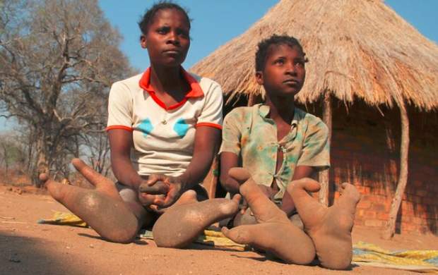 قبیله‌ای آفریقایی با پاهای عجیب +تصاویر
