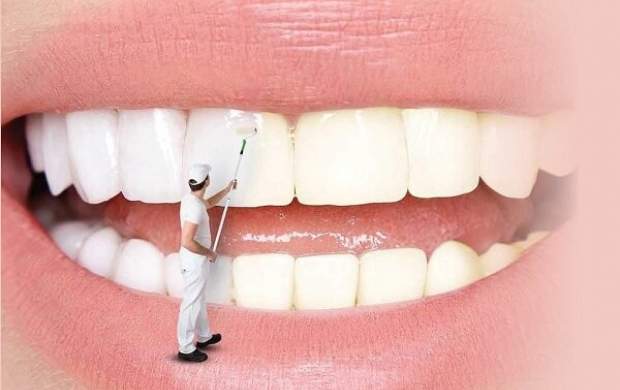 دلیل جرم گرفتن دندان چیست؟