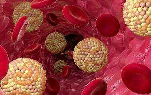 عوارض کلسترول بالا و بد خون برای بدن