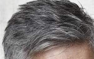 سفید شدن موها و راه‌های جلوگیری از آن