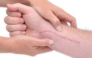 چرا جای زخم روی پوست باقی می‌ماند؟