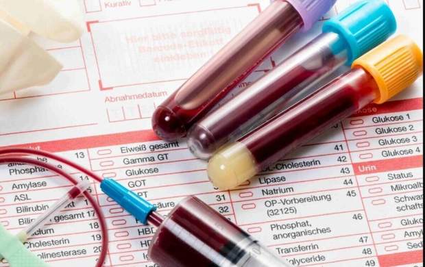 آزمایش گاز خون چیست و کاربرد آن چیست؟