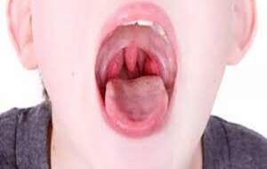 دلایل بزرگ شدن زبان کوچک در دهان