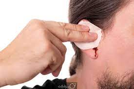 علت خونریزی گوش چیست؟