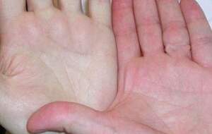 چرا کف دست عرق می‌کند؟