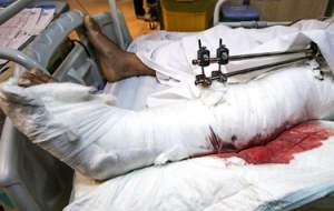 مصدومان حادثه تروریستی شاهچراغ +عکس