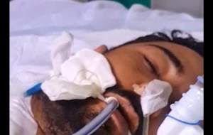 پیوند سر قطع شده جوان ایرانی (۱۸+) +فیلم  <img src="https://cdn.jahannews.com/images/video_icon.png" width="16" height="16" border="0" align="top">