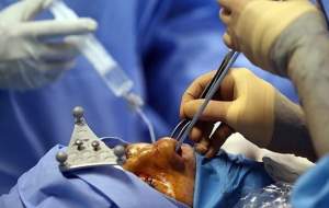 سونامی افسار گسیخته جراحی زیبایی ایران