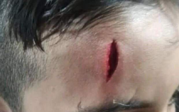 تنبیه بدنی دانش‌آموز خرم‌آبادی