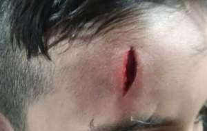 تنبیه بدنی دانش‌آموز خرم‌آبادی