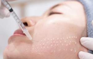 خطر کوری چشم‌ها در اثر تزریق ژل جدی است