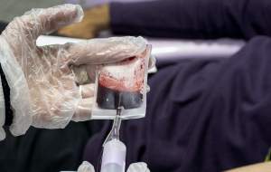 ذخیره بیش از ۳۵۰ واحدخون نادر در ایران