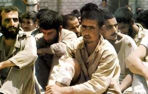 عصب کشی دندان با سیم خاردار!