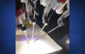 کاردستی یک جراح با ربات  <img src="https://cdn.jahannews.com/images/video_icon.png" width="16" height="16" border="0" align="top">