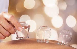 تفاوت فصد و حجامت در چیست؟ +فیلم  <img src="https://cdn.jahannews.com/images/video_icon.png" width="16" height="16" border="0" align="top">