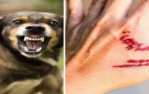 کمین وحشتناک سگ‌های ولگرد