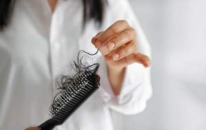 غذایی که باعث ریزش مو می‌شود