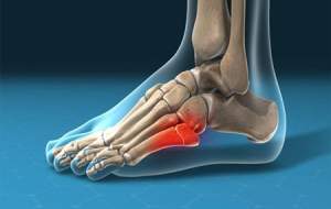 کفش مناسب پیاده روی اربعین