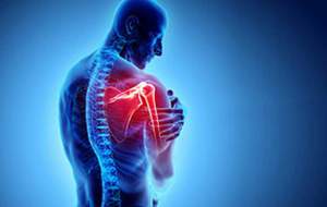 شانه یخ‌زده و راه درمان آن چیست؟  