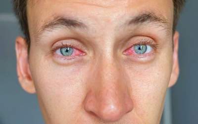 چگونه جسم خارجی رااز چشم خارج کنیم؟