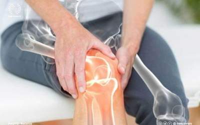 پوکی استخوان در نیمی از جمعیت کشور