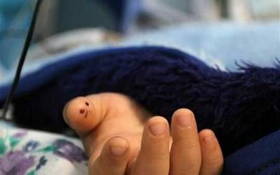 مرگ مشکوک ۲ کودک تهرانی پس از مصرف ماکارونی