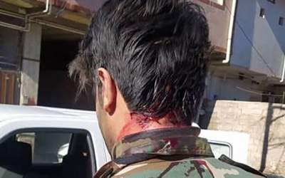 حمله با تبر به مامور منابع طبیعی +عکس