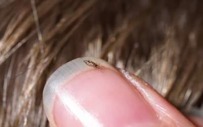 شایعه تعطیلی مدارس به دلیل «شپش» تکذیب شد