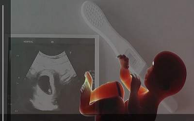 مجازات پزشکانی که سقط جنین انجام می‌دهند