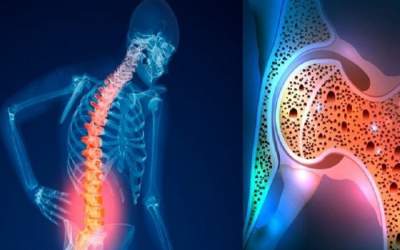 راهکاری برای پیشگیری از پوکی استخوان  <img src="https://cdn.jahannews.com/images/video_icon.png" width="16" height="16" border="0" align="top">