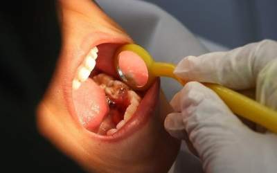 حفظ سلامت دهان و دندان در طول روزه‌داری