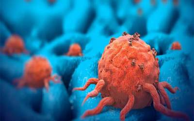 درمان سرطان‌های سخت ممکن می‌شود