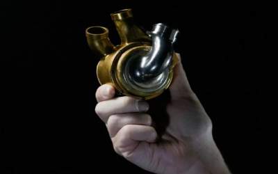 ١٠٠ روز زندگی با قلب مصنوعی!