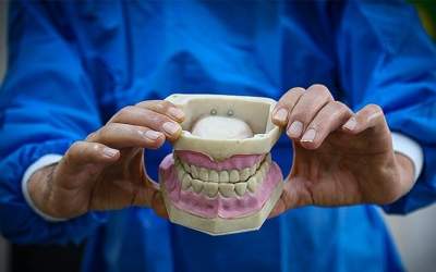 وزارت بهداشت: ۱۵ درصد ایرانی‌‌ها مسواک نمی‌زنند