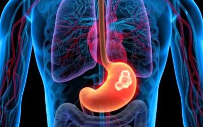 زخم معده چیست و چگونه به وجود می‌آید؟  <img src="https://cdn.jahannews.com/images/video_icon.png" width="16" height="16" border="0" align="top">