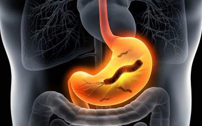 فیلم/ از زخم معده و باکتری‌ها چه می‌دانید؟  <img src="https://cdn.jahannews.com/images/video_icon.png" width="16" height="16" border="0" align="top">