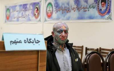 ماده ۴۷۷ چه نقشی در پرونده "تتلو" دارد؟