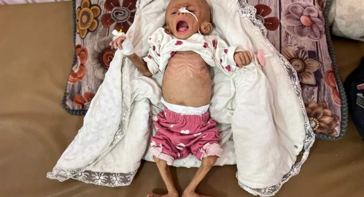 شهادت نوزاد ۶ ماهه فلسطینی بر اثر گرسنگی