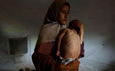 سازمان ملل: قحطی در غزه عامدانه است