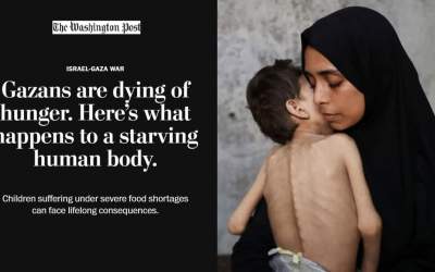 اثرات جبران ناپذیر گرسنگی بر کودکان غزه