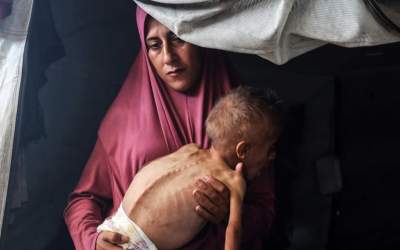 کودک ۱۰ ساله فلسطینی، هم‌وزن نوزاد ۱۲ ماهه!  <img src="https://cdn.jahannews.com/images/video_icon.png" width="16" height="16" border="0" align="top">