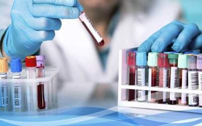 آخرین خبر از پرونده جنجالی گم شدن جنین‌ها