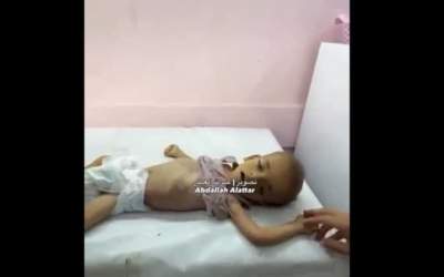 شهادت نوزاد ۱ ساله فلسطینی بر اثر گرسنگی شدید  <img src="https://cdn.jahannews.com/images/video_icon.png" width="16" height="16" border="0" align="top">
