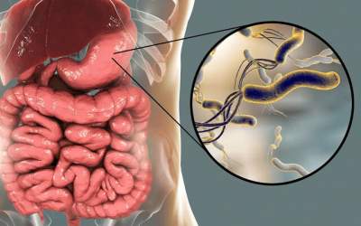 باکتری دشمن معده را بشناسید!  <img src="https://cdn.jahannews.com/images/video_icon.png" width="16" height="16" border="0" align="top">